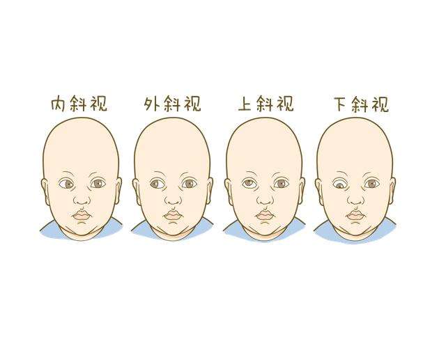 经颅磁家用品牌选择_发育迟缓和脑瘫一样吗