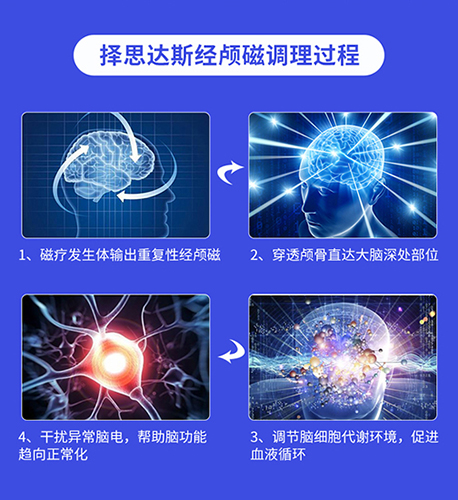 择思达斯经颅磁家庭用效果好吗？